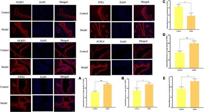 The Ferroptosis-NLRP1 Inflammasome: The Vicious Cycle of an Adverse Pregnancy